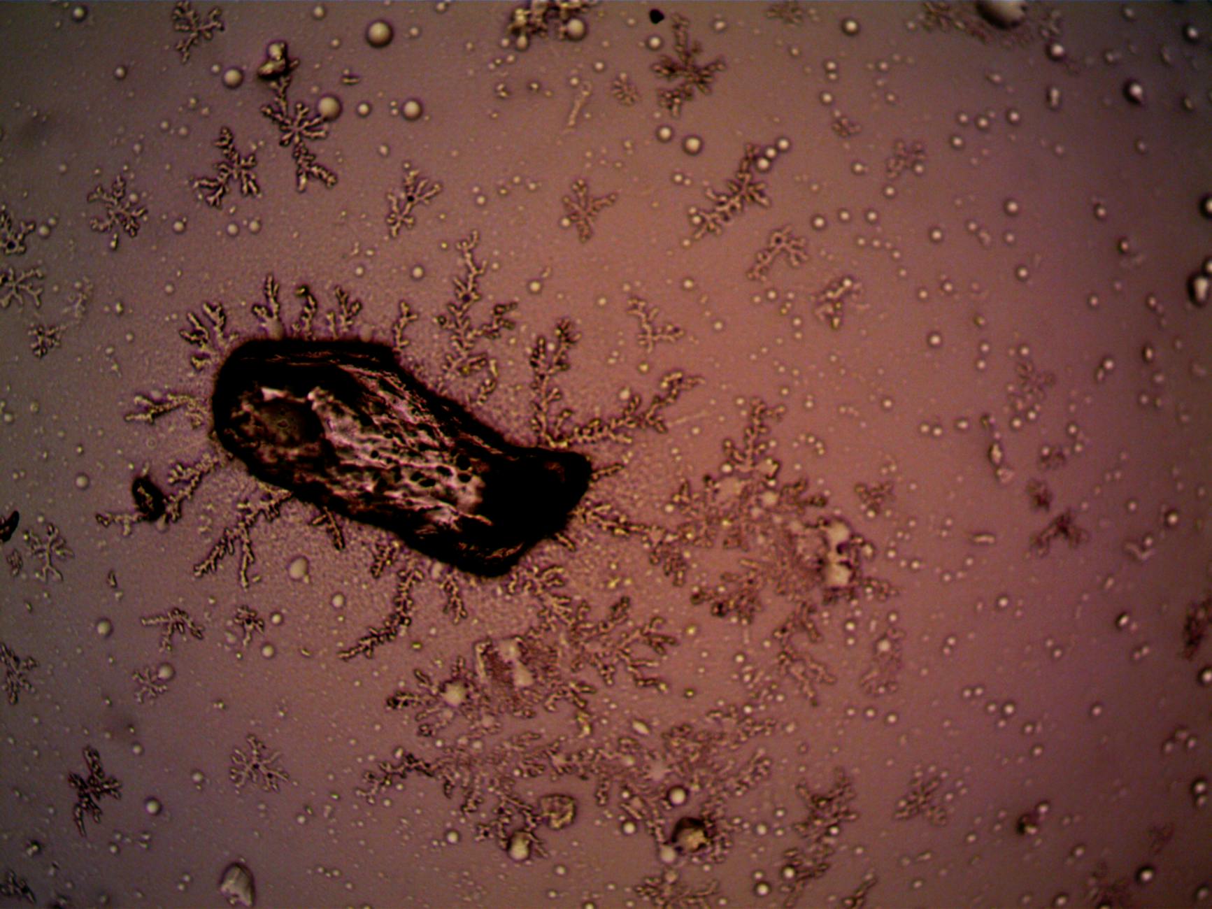Bacteria and Crystal Formations Under Microscope Microscopic view of bacteria and crystal formations illustrating microbial growth on surfaces
