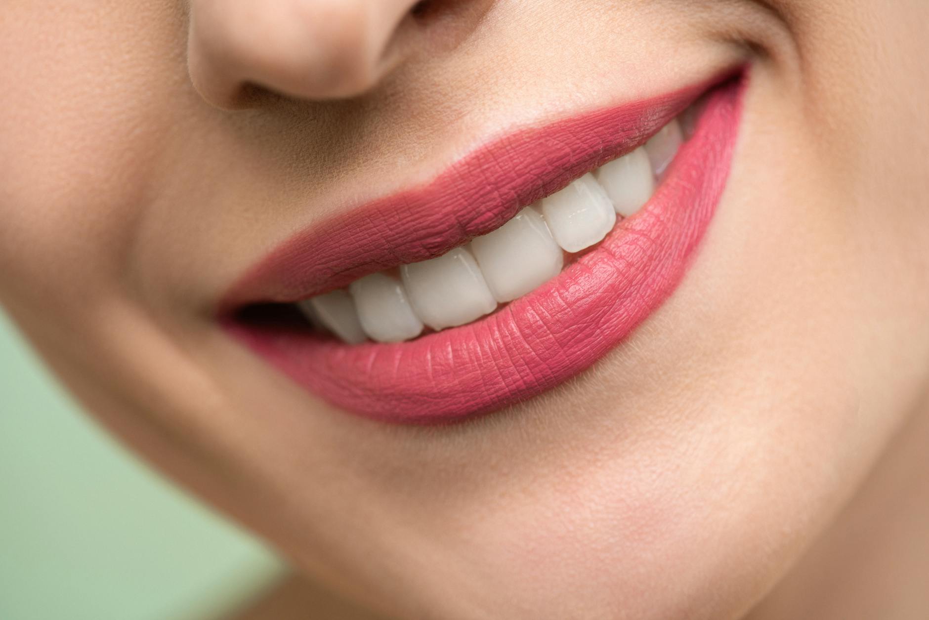 Protecting Your Smile From Foods That Stain Teeth Close-up of a woman's bright white smile — the goal of understanding what causes yellow teeth