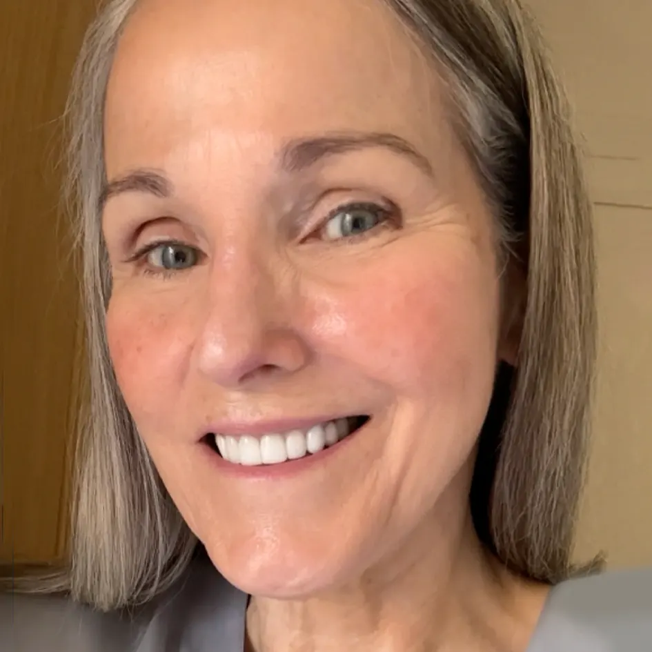 Glamory MicroLift System real customer review 2026 Glamory MicroLift System customer review — Melissa's 30-day results and testimonial
