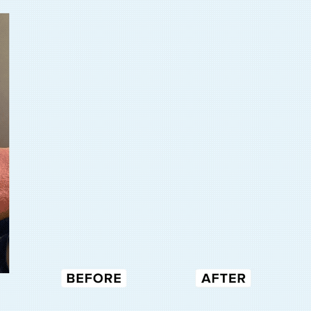 Laughland Dentist-Formulated Whitening — Clinical Foundation 2026 Dental professional reviewing teeth alignment model — Laughland dentist-formulated whitening kit