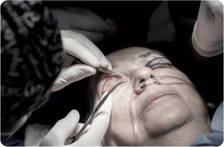 Renewa EyeLift Daily Use at Home 2026 Renewa EyeLift lifestyle shot showing the device being used at home