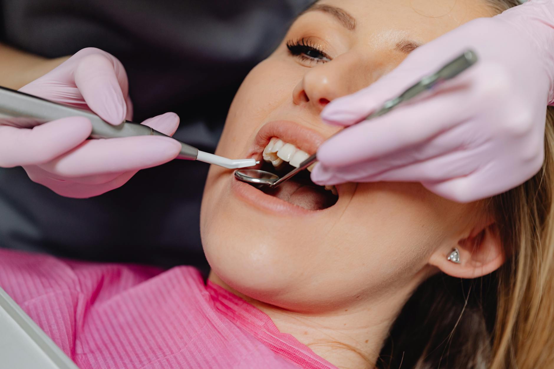 Professional Dental Care for Whitening Sensitivity Treatment Dental professional performing a tooth treatment in a clinic setting