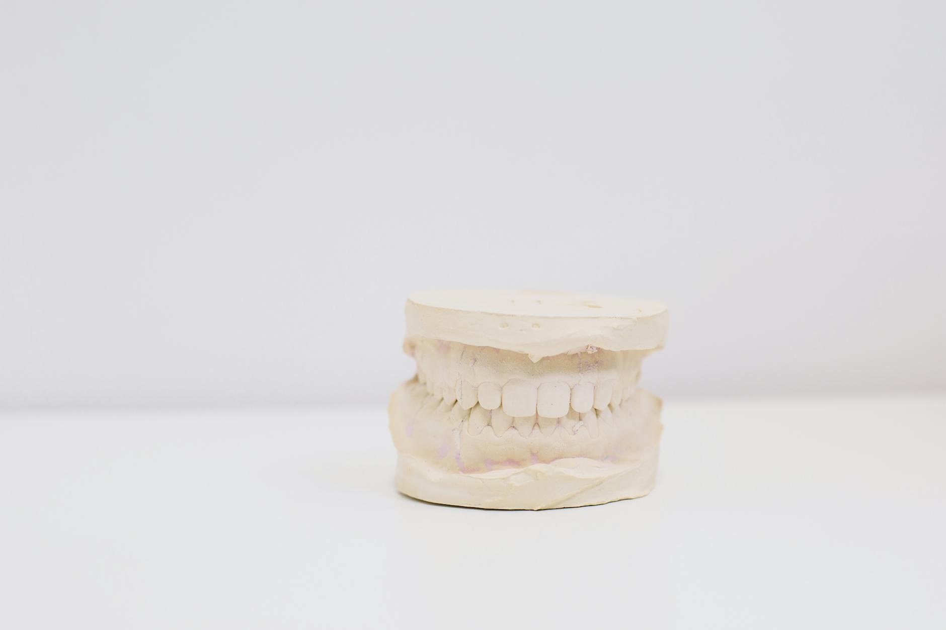 Snap-On Veneers: How They Work, Who They're For, and What to Expect