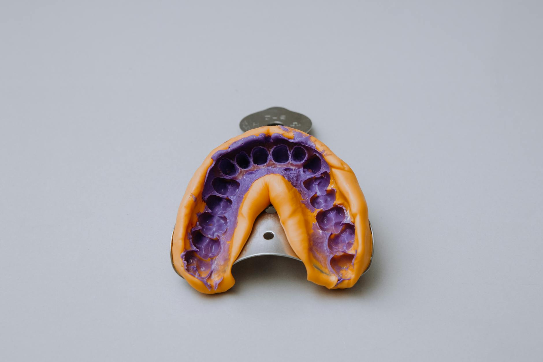 Dental Impression Tray for Custom Removable Veneers Dental impression tray with purple molding material used to create custom snap-on veneers