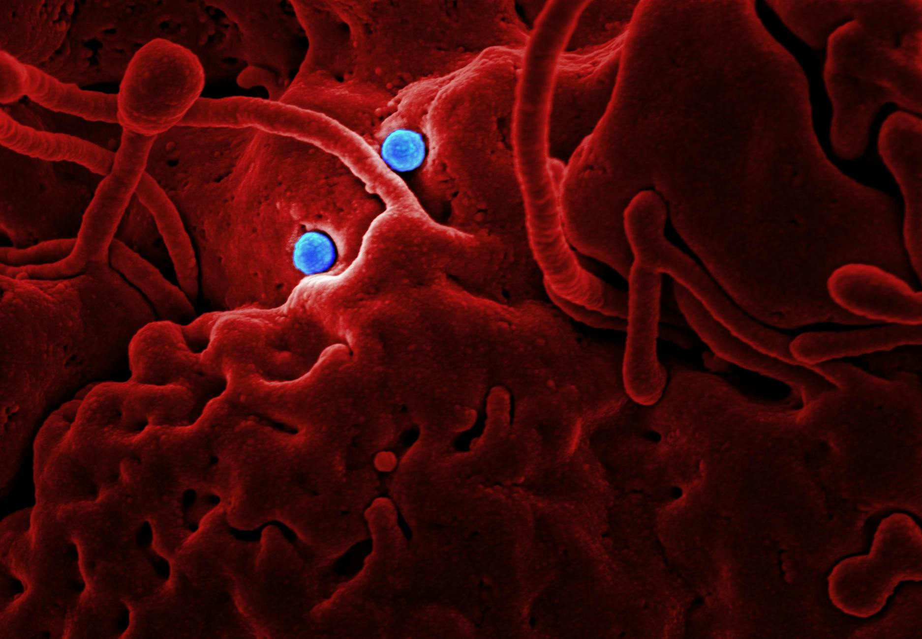 Virus Particles Under Microscope - UV-C Light Targets Microscopic image of virus particles — the targets of UV-C germicidal irradiation